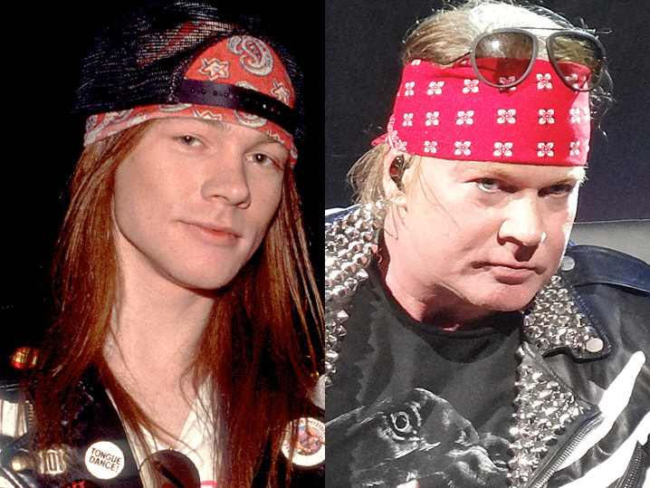 Axl Rose Before And After